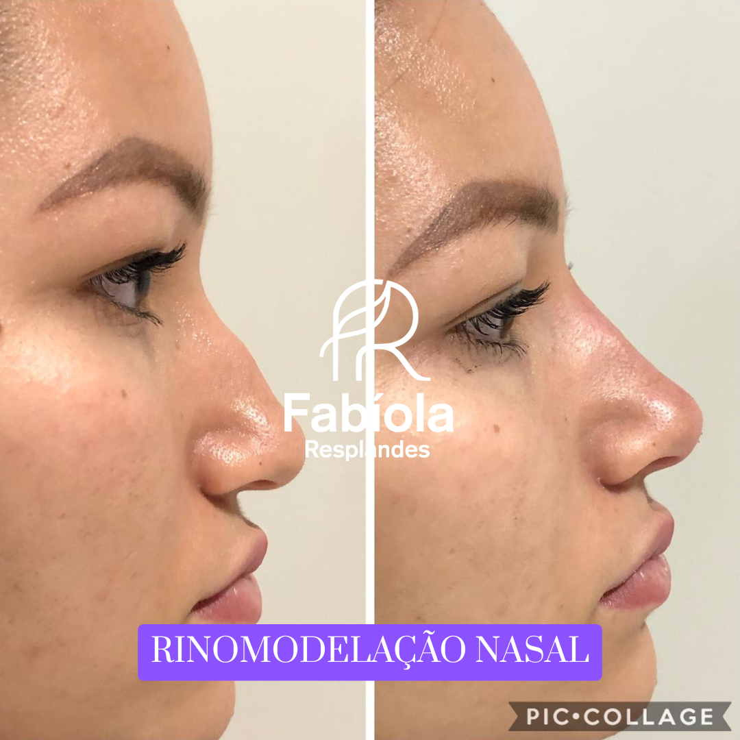 PROVAS SOCIAL - ESSENCE CLIN